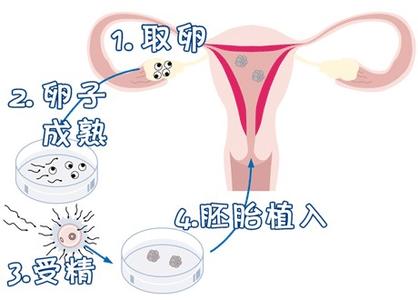 王晨光主任